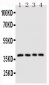 Anti-CD1d Antibody