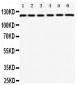 Anti-Coxsackie Adenovirus Receptor Antibody