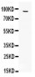 Anti-FES Antibody