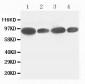 Anti-FES Antibody