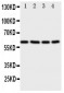 Anti-RIP2 Antibody