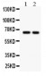 Anti-TGFBR2 Antibody
