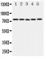 Anti-ABCG1 Antibody