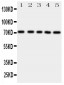 Anti-BCRP/ABCG2 Antibody