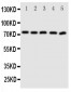 Anti-ABCG5 Antibody