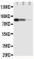 Anti-CD163 Antibody