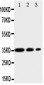 Anti-CD163 Antibody