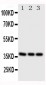 Anti-CD1a Antibody