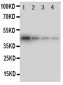 Anti-MCK10 Antibody