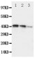 Anti-DDR2 Antibody