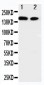 Anti-ErbB 4 Antibody