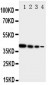 Anti-ErbB 4 Antibody