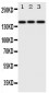 Anti-ErbB 4 Antibody