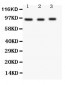 Anti-FER Antibody