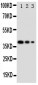 Anti-GATA2 Antibody