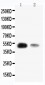 Anti-KLF8 Antibody