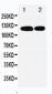 Anti-p107 Antibody