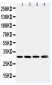 Anti-SOD3 Antibody