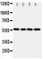 Anti-TXNRD2 Antibody