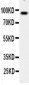 Anti-CSF3R/G-CSF R Antibody