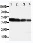 Anti-DLL3 Antibody