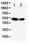 Anti-Flt-3ligand Antibody