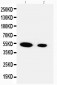 Anti-FLRG/FSTL3 Antibody