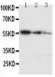 Anti-Ki67 Antibody