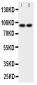 Anti-MALT1 Antibody