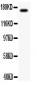 Anti-MEKK1 Antibody