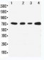Anti-MEKK3 Antibody