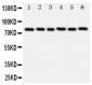 Anti-B MyB Antibody