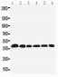 Anti-Nucleophosmin Antibody