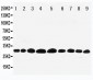 Anti-Prohibitin Antibody