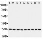 Anti-mtTFA Antibody