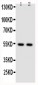Anti-NFkB p100/p52 Antibody