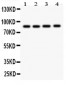 Anti-NOX5 Antibody