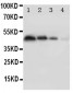 Anti-PECAM-1/CD31 Antibody