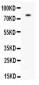 Anti-PECAM-1/CD31 Antibody