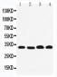 Anti-REA Antibody