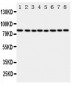 Anti-POR Antibody