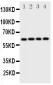 Anti-SQSTM1/p62 Antibody