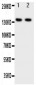 Anti-ZEB2 Antibody