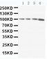 Anti-RIAM Antibody