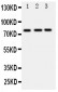 Anti-DDX4/MVH Antibody