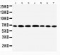 Anti-DDX5 Antibody