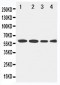 Anti-LCAT Antibody