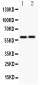 Anti-LTBR Antibody