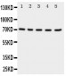 Anti-Neuregulin-1 Antibody