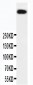 Anti-DNA PKcs Antibody